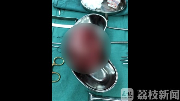 江苏各大医院手术有序开展 急诊、肿瘤患者优先