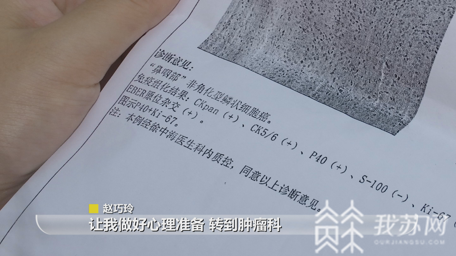 连衣裙■这个坚强的女孩 如今又患上癌症 19岁才穿上人生第一件连衣裙