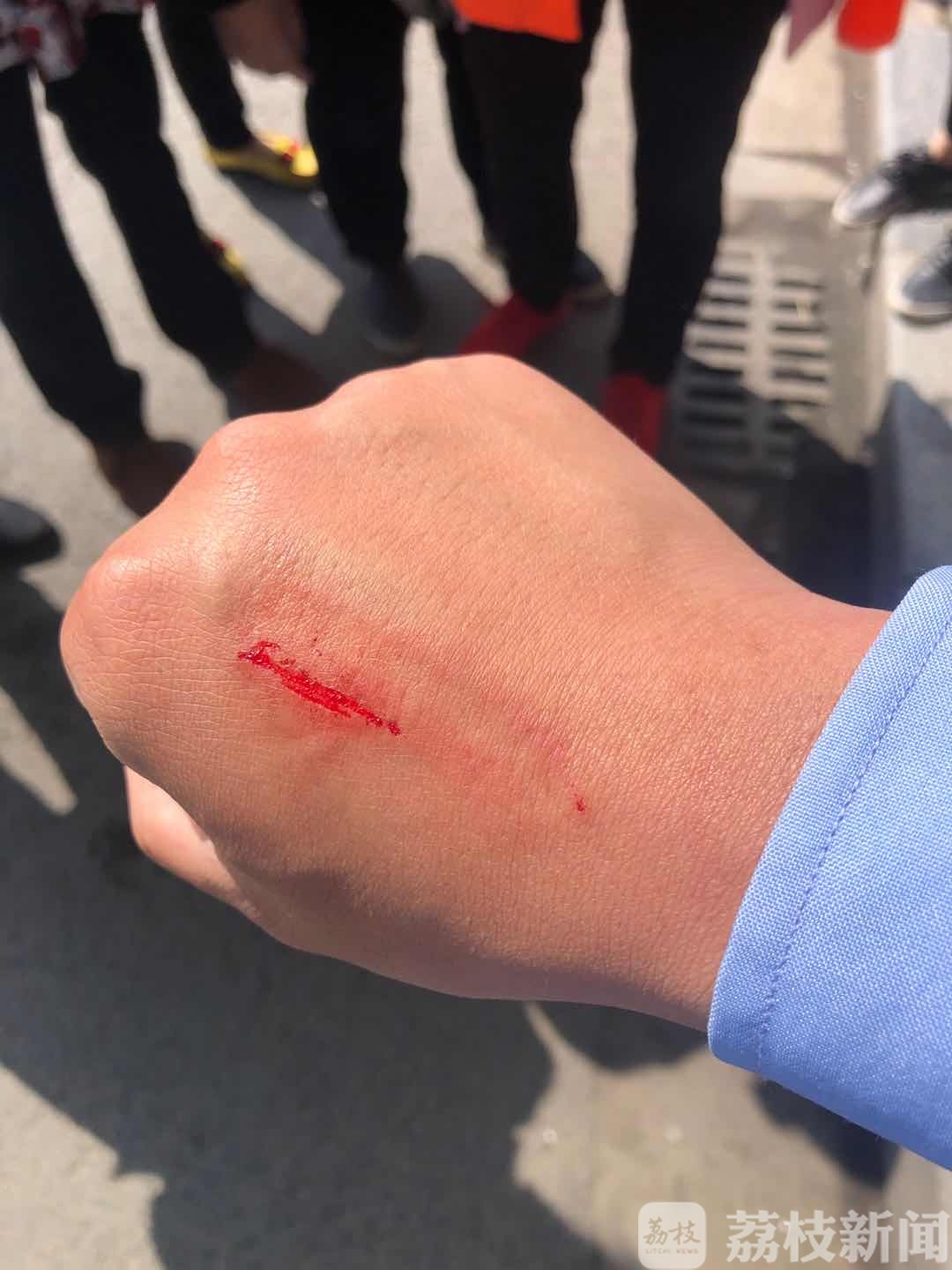 民警■老人逆向行驶不听劝导还咬伤民警被拘留