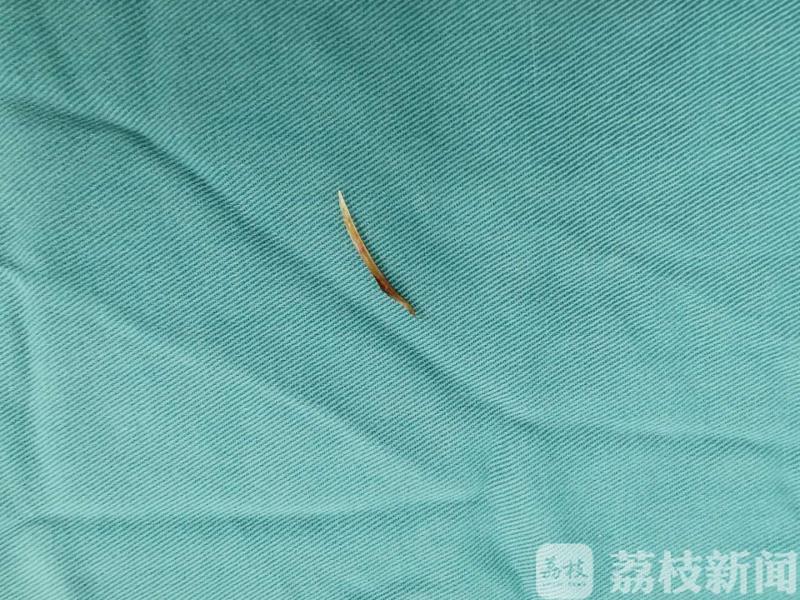 ■鱼刺卡喉,男子大口吃米饭强吞,结果……