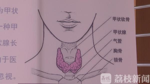原来真的有“懒癌” ！而且发病率还越来越高