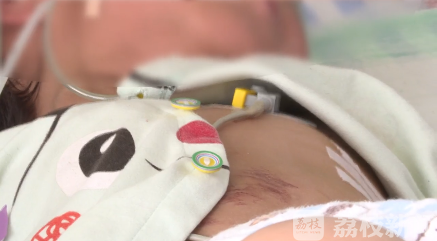 『晾衣架』多亏晾衣架缓冲奇迹生还 万幸!3岁女童8楼坠落