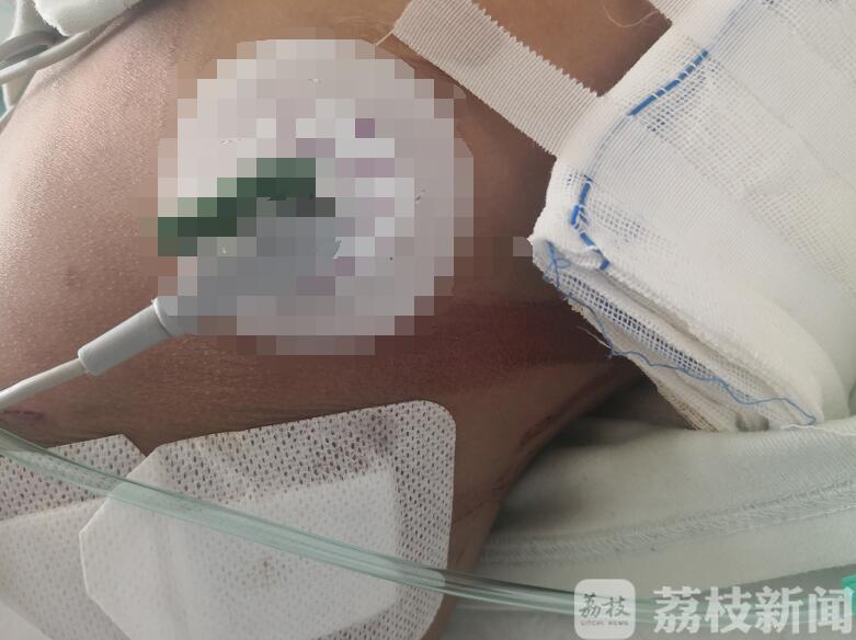 『幼童』 竟是因为… 3岁幼童从8楼掉下只擦破皮
