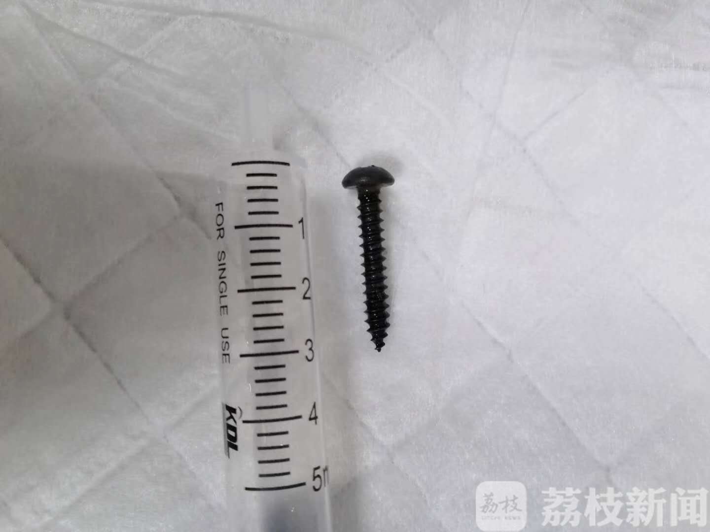 螺丝钉■1岁幼儿误服尖头螺丝钉,医师妙手取出未伤分毫