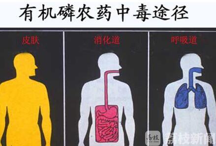 农药■“秘方”竟是农药！七旬老汉听信“神医”治病险丢命