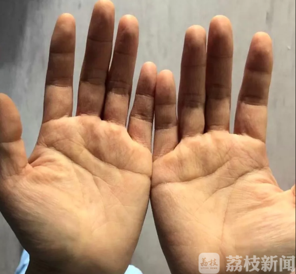 前线速递|她把防护服当作最美的衣服