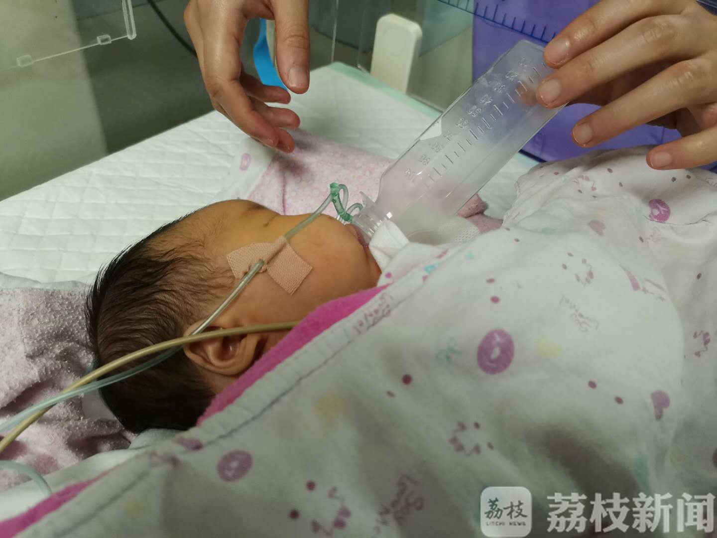 爱心接力■跨越1500公里的爱心接力：贵州女婴在苏州顺利完成“修心”手术