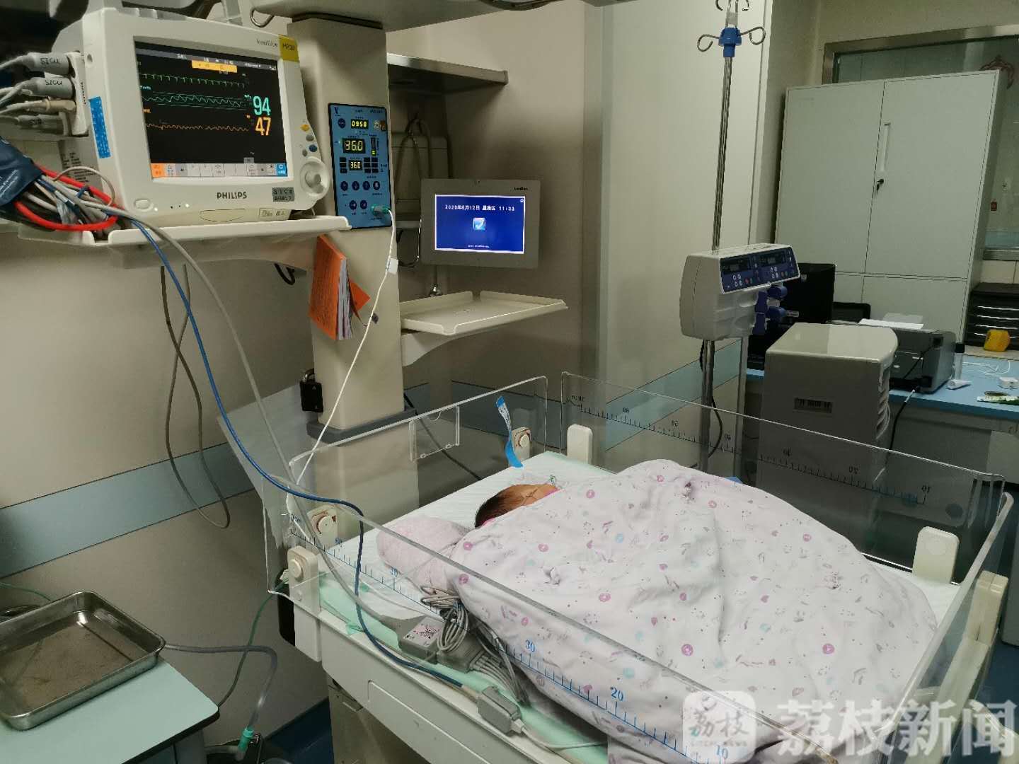 爱心接力■跨越1500公里的爱心接力：贵州女婴在苏州顺利完成“修心”手术