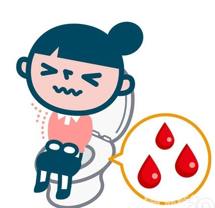 便血■罕见!九岁患儿便血六年多,竟是……
