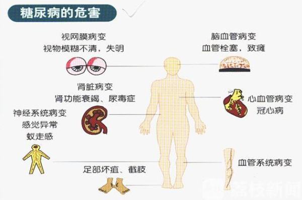 28岁顽固性糖尿病小伙靠电极卸下“甜蜜的负担”