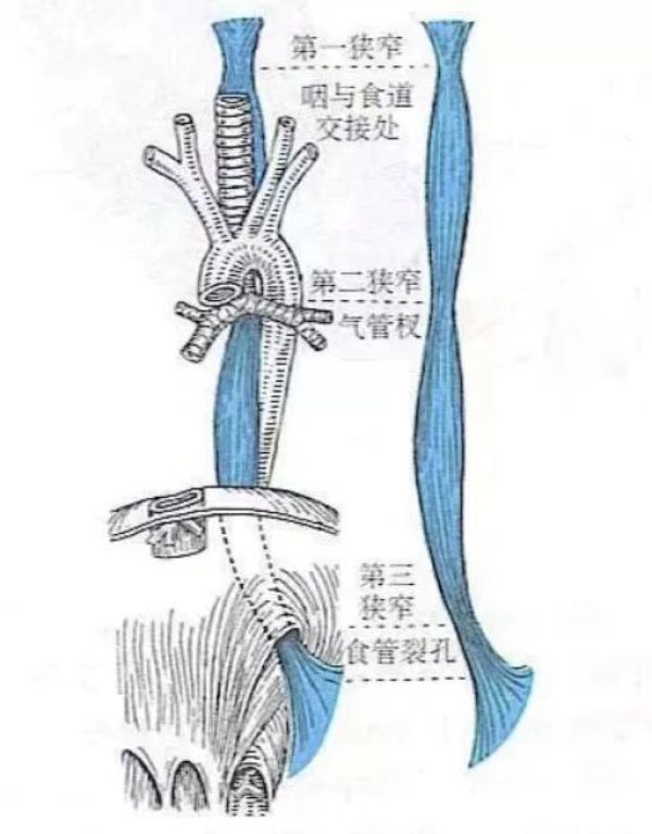 食物就容易卡在這三個地方,分別位於食管起始處,食管與左支氣管交點處