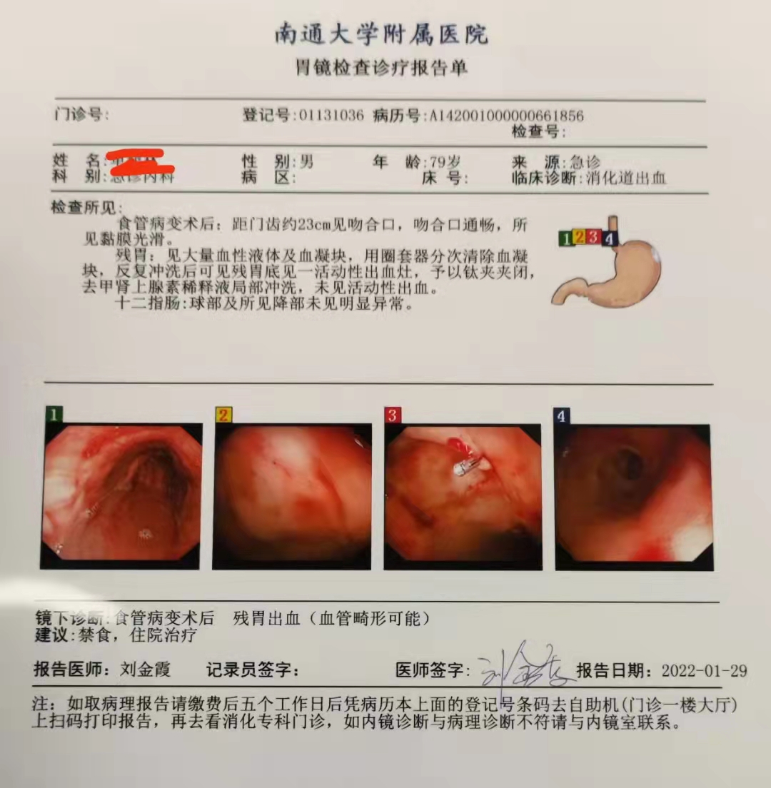 10年上消化道出血6次通大附院查出罕见病因