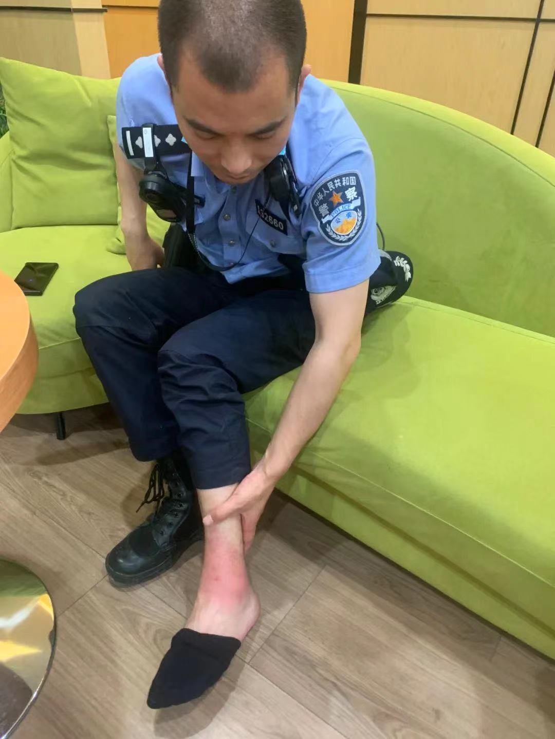 警察的脚受伤图片